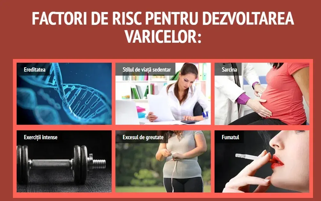 Varixil forte compoziție - România - cumpără - recenzii - pareri - ce este - comentarii - preț - in farmacii.